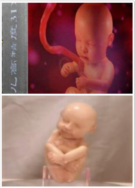 3D打印胎兒